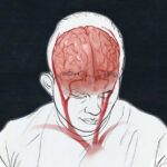 Fear for Sleep: COVID’s Deadly Breathing Threat Here's what we know about COVID-19's impact on the brain