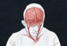 Here's what we know about COVID-19's impact on the brain