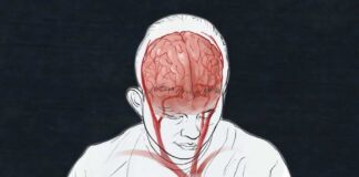 Here's what we know about COVID-19's impact on the brain