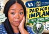 The VA PAID for My Dental Implant! 😲 | My Honest Experience & Recovery