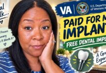 The VA PAID for My Dental Implant! 😲 | My Honest Experience & Recovery